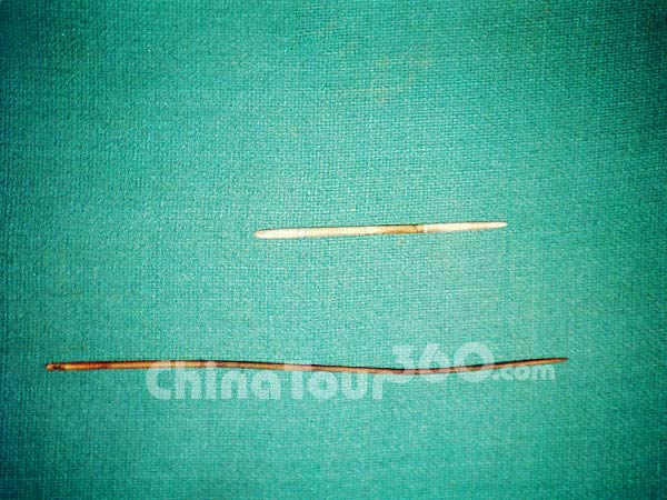 Needles of ancient China